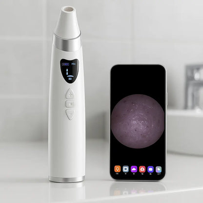 Blackhead Suction Vacuum | Electric Pore Cleaner | Novara Shop