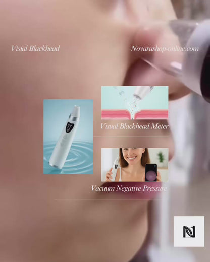 Blackhead Suction Vacuum | Electric Pore Cleaner | Novara Shop